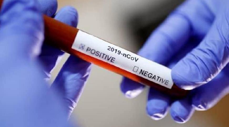 وزارة الصحة تعلن عن تسجيل سادس حالة إصابة مؤكدة بفيروس كورونا
